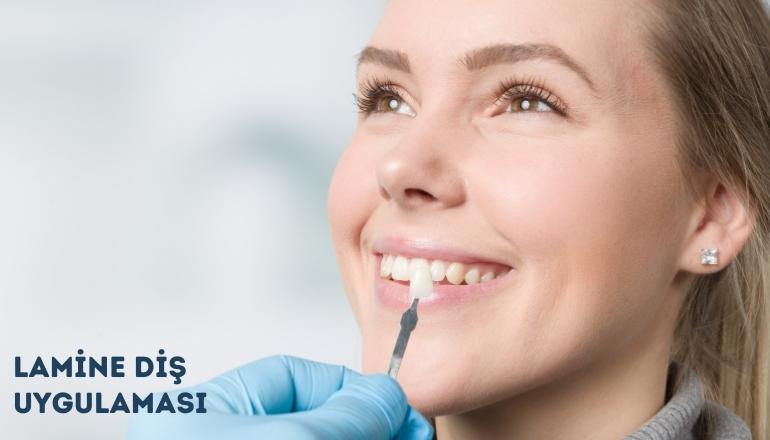 What Is Smile Design?